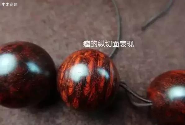 瘤疤的分類主要還是在于瘤